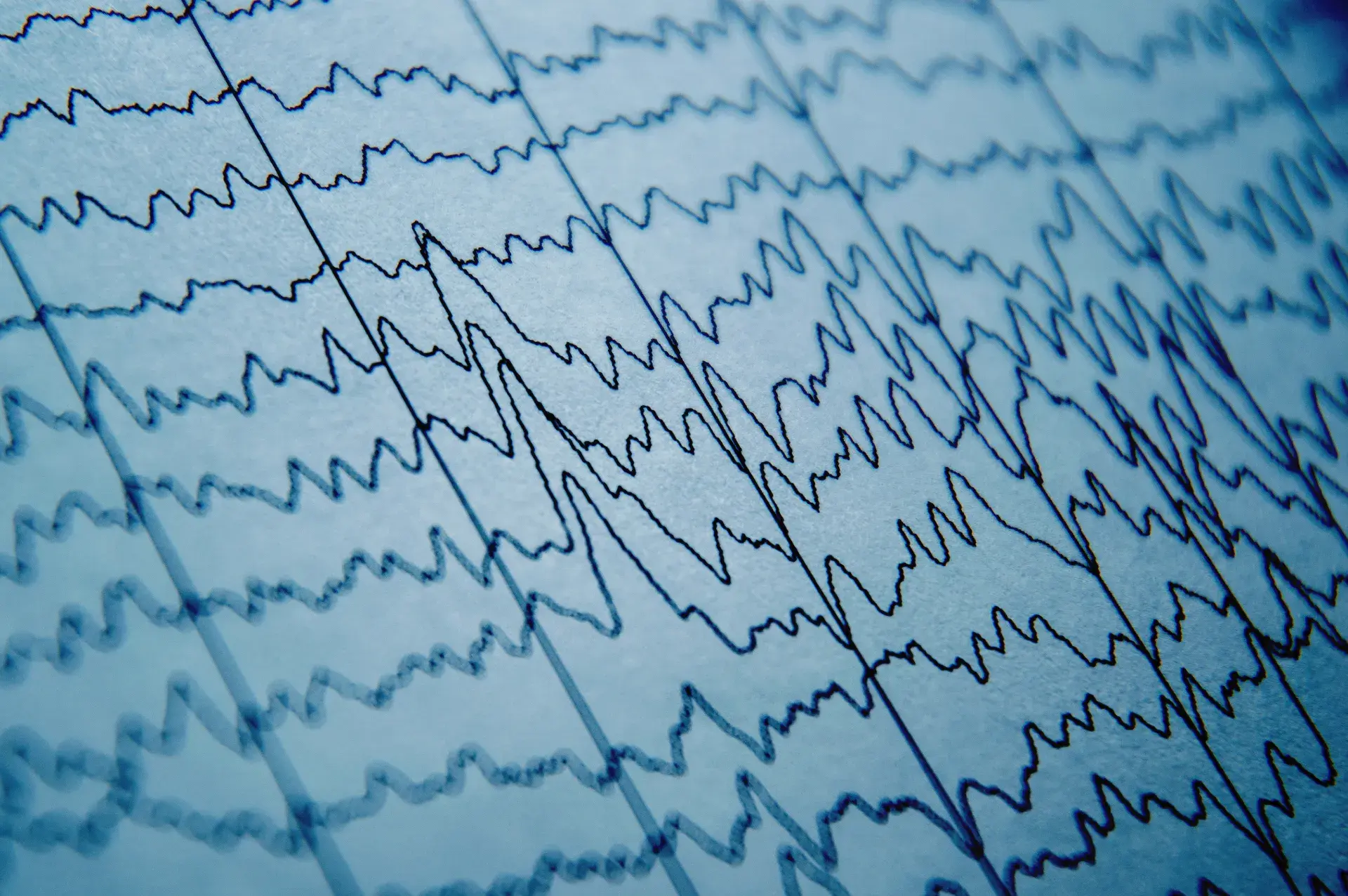 A close-up view of an electroencephalogram (EEG) recording, displaying a series of wavy lines that represent the brain's electrical activity. This data is used for diagnosing neurological conditions or studying brain function.